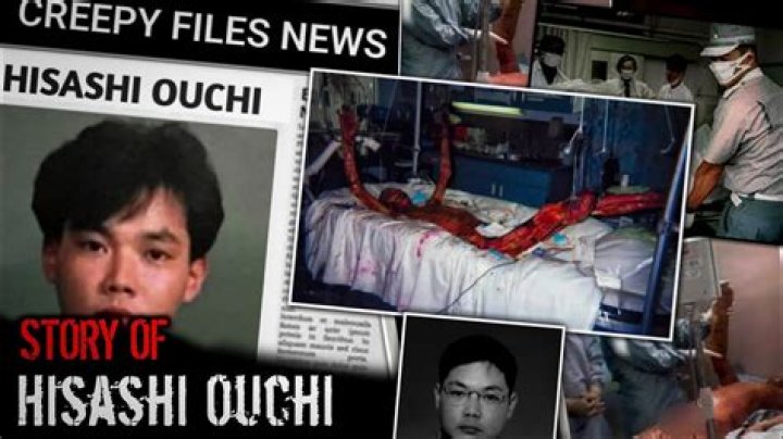 Unseen Photos Of Hisashi Ouchi: A Tragic Reality Revealed
